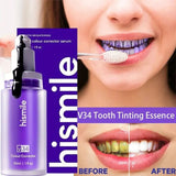 Hismile v34 Instant Teeth Whitening
