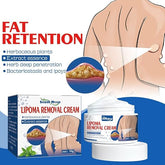 South Moon Lipoma Removal Cream