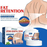 South Moon Lipoma Removal Cream