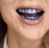 Hismile v34 Instant Teeth Whitening