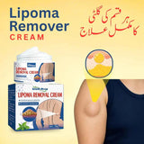 South Moon Lipoma Removal Cream